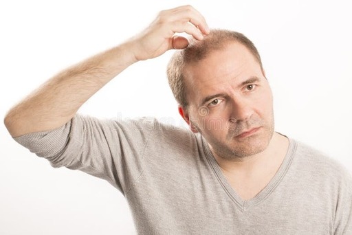 Hair Transplant in Dubai Your Ultimate Solution to