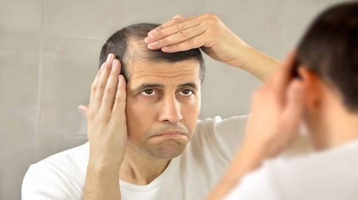 Availability of skilled surgeons for Hair Restorat