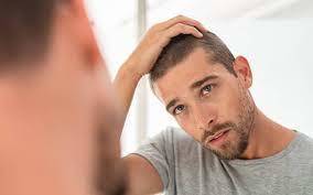 Stem Cell Fue Hair Transplant in  Dubai7.jpg