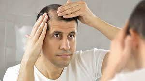 Dubai's Trusted Experts in Hair Fall Treatment.jpg